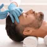 Man getting a hair rejuvenation injections