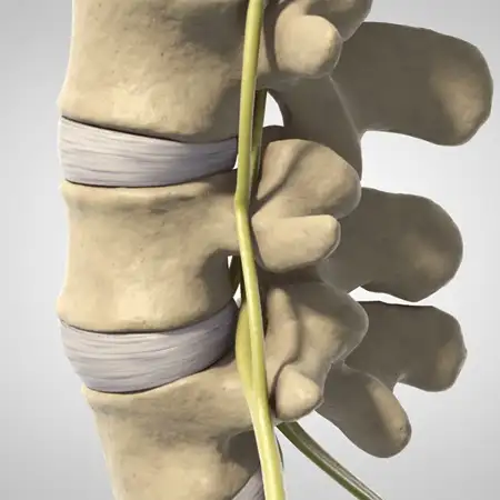 Degenerative conditions