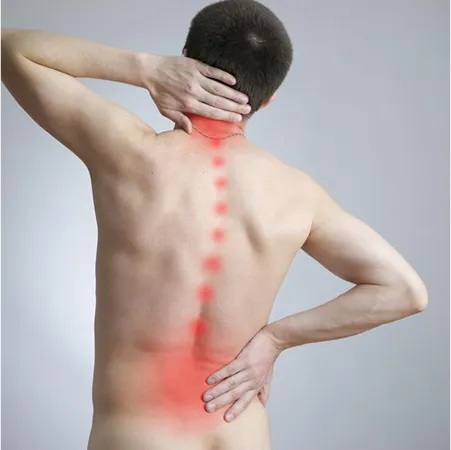 Herniated and bulging discs