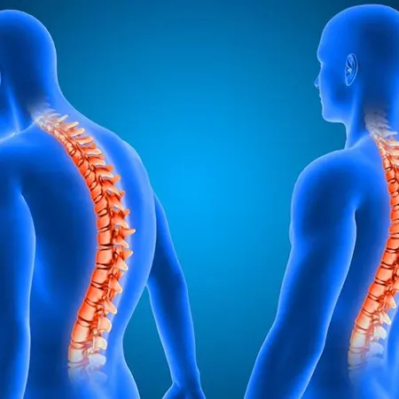 Posture-related back pain