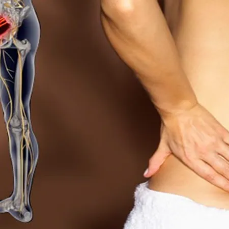 Sciatica and nerve pain