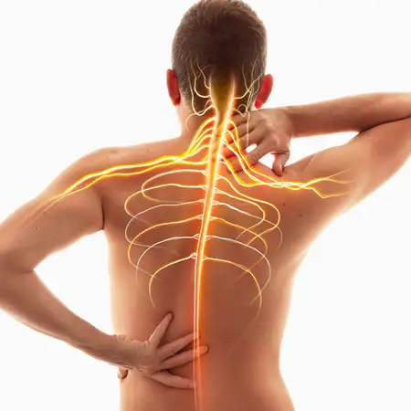 Spinal Misalignments: Affecting nerve function and overall posture